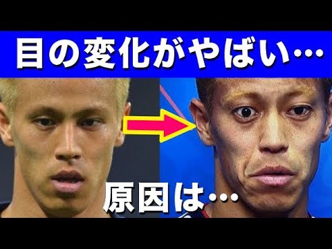 本田圭佑の 目 がおかしい バセドウ病と決して認めず日本代表のエースとして結果を出す男の姿が泣ける セネガル戦で乾とともにゴールを決める ロシアw杯 Yu Yurara